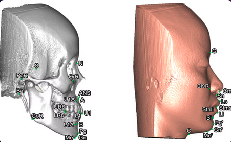 Cirurgia Ortogn&aacute;stica